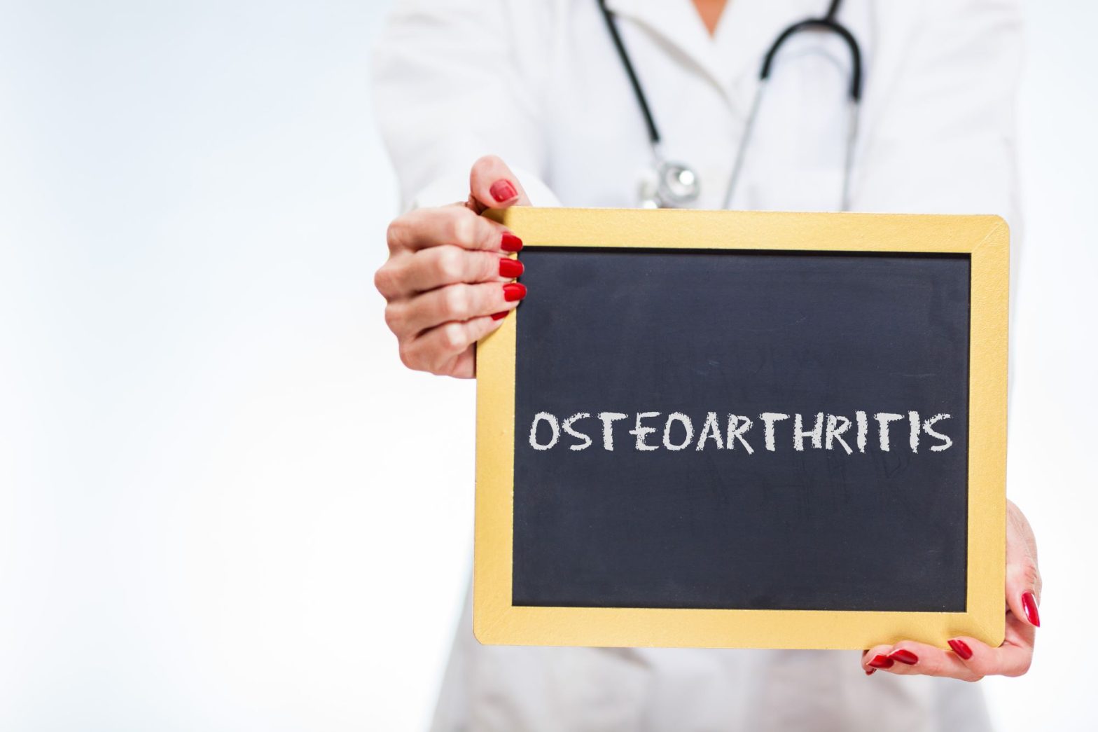 Osteoarthritis sign