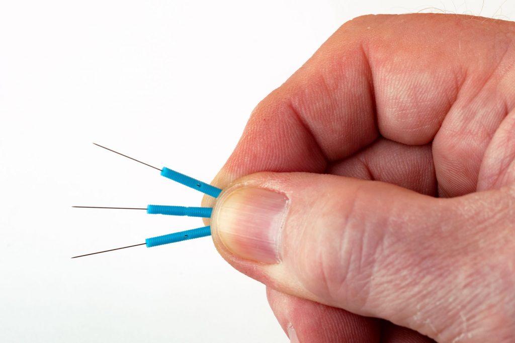 acupuncture needles