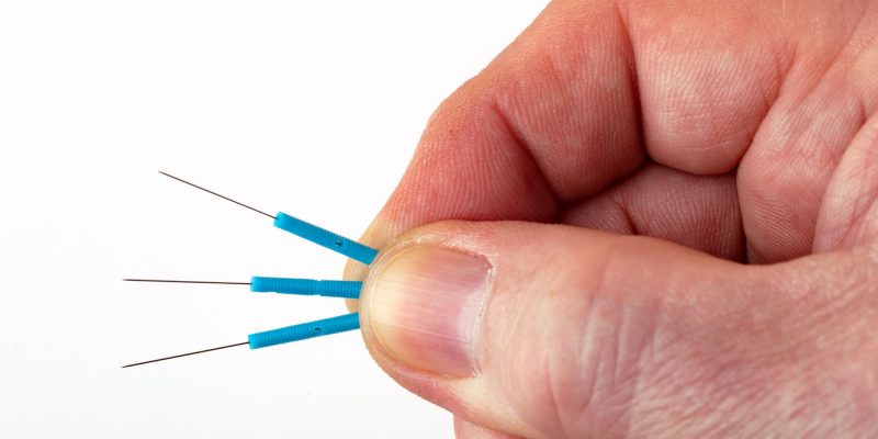 accupuncture needles