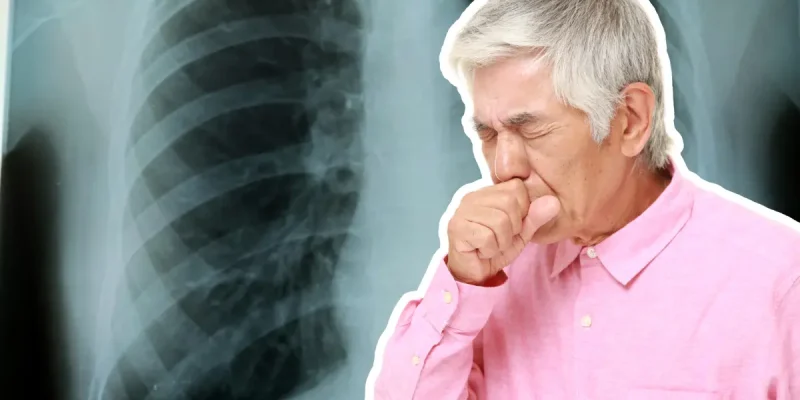 coughing man with chest xray in the background, copd