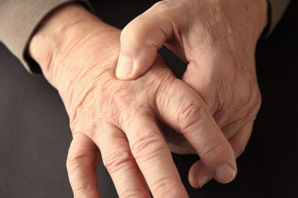 hand with pain