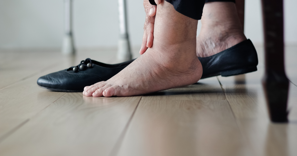 swollen feet, indicating possible heart issue