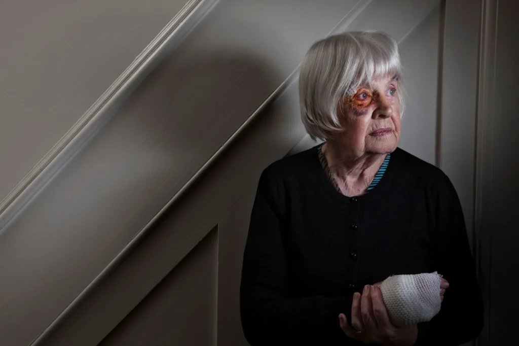 older lady battered sitting on stairs