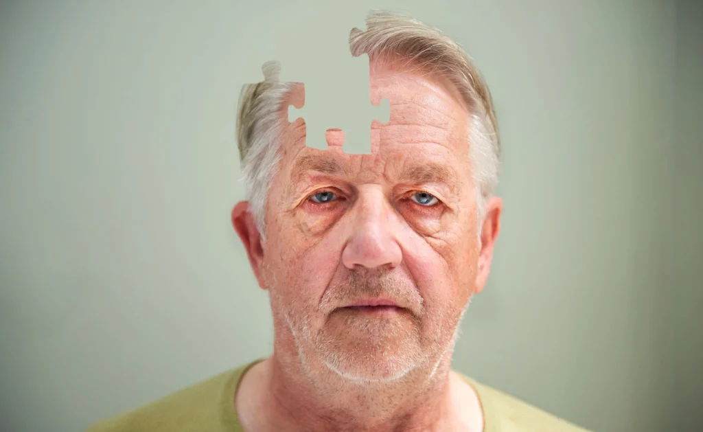 older man brain structure changes