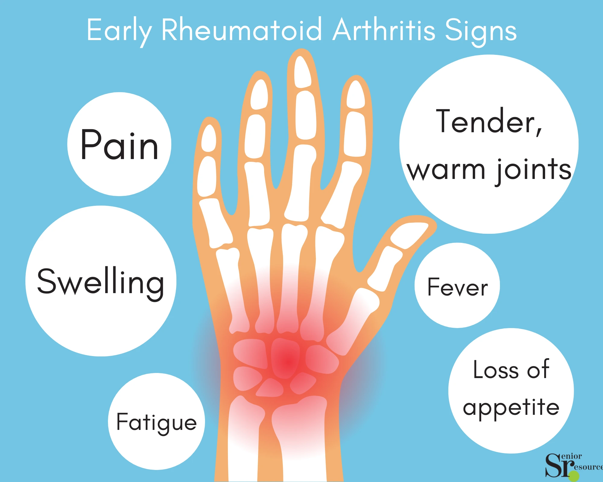 early signs of rheumatoid arthritis infographic by senior resource