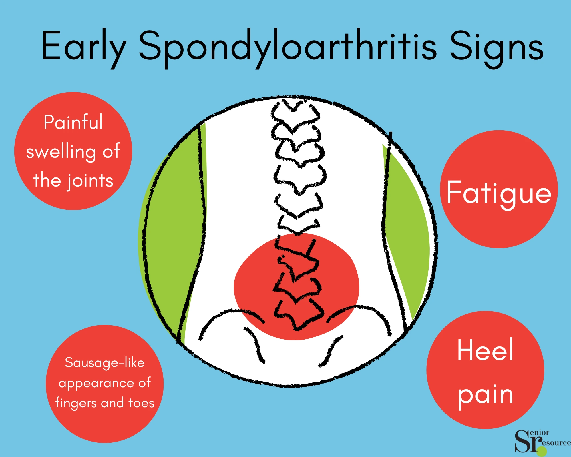 Early Spondyloarthritis Signs infographic by senior resource